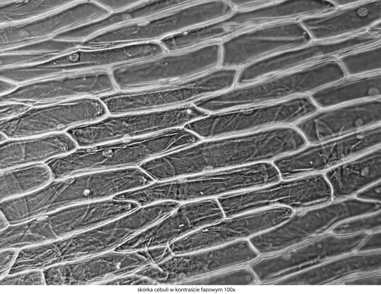 genetic-pro-bino_20151130_144105_741163-3-.jpg