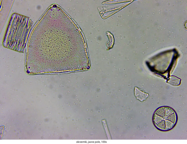 genetic-pro-bino_20151130_144105_970208-3-.jpg