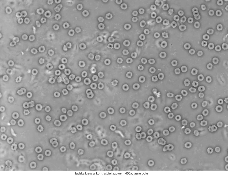 genetic-pro-bino_20151130_144104_777258-3-.jpg