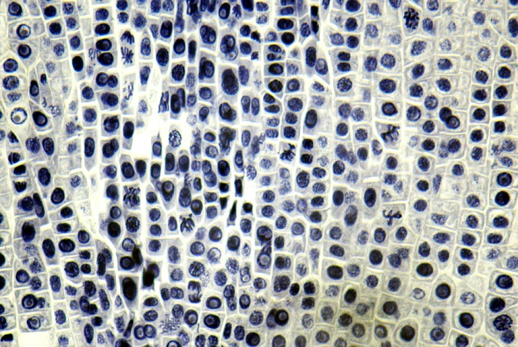 1000x670_product_media_44001-45000_2019_03_14_09_54_51_B_Radius8_Smoothing3_x400_korzen_bob-j.webp