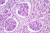 1000x671_product_media_44001-45000_zapalenie_nerek_200x_0005-j.webp