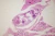 1000x667_product_media_45001-46000_Trichinella_spiralis_400x-j.webp