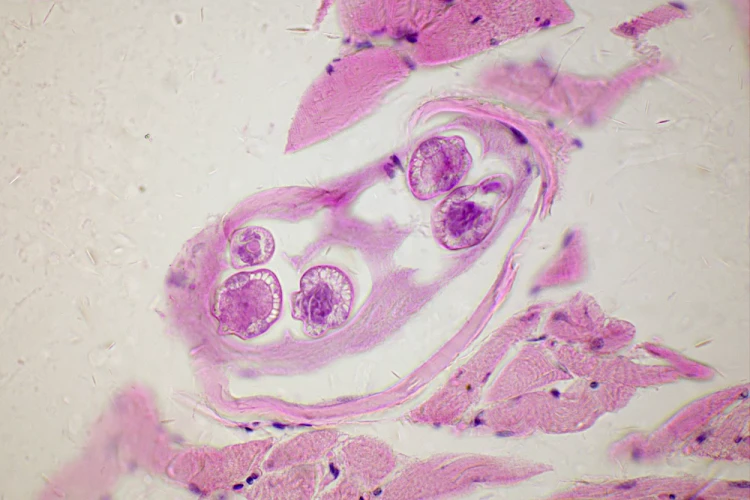 1000x667_product_media_45001-46000_Trichinella_spiralis_400x-j.webp
