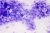 1000x667_product_media_45001-46000_Trichomonas_vaginalis_400x-j.webp