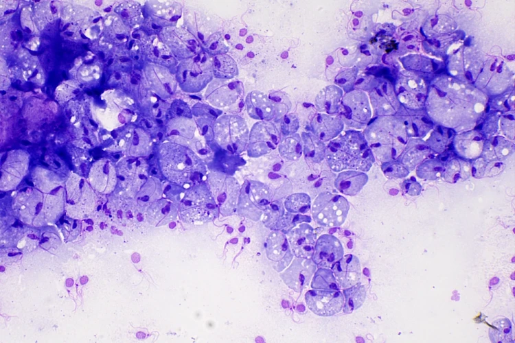 1000x667_product_media_45001-46000_Trichomonas_vaginalis_400x-j.webp