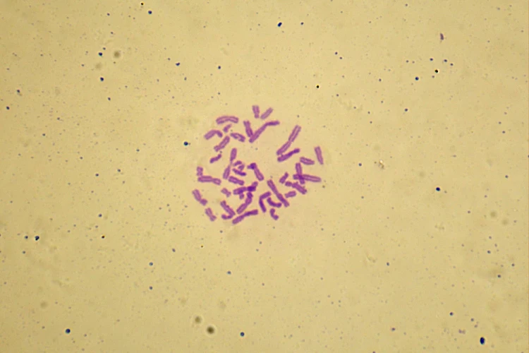 1000x667_product_media_45001-46000_Chromosomy_1000x-j.webp