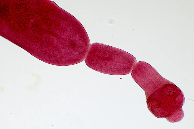 1000x667_product_media_45001-46000_Echinococcus_granulosus_100x-j.webp